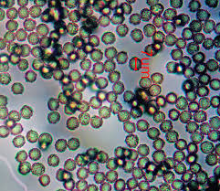 Attēlu rezultāti vaicājumam “Siphoptychium violaceum macro”