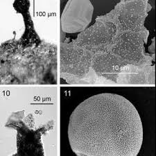 Attēlu rezultāti vaicājumam “Licea pusilla spores”