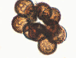 Attēlu rezultāti vaicājumam “Badhamia foliicola spores”