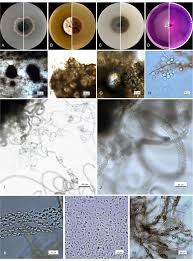 Attēlu rezultāti vaicājumam “Diderma radiatum plasmodium”