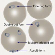 Attēlu rezultāti vaicājumam “Diderma umbilicatum plasmodium”