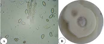 Attēlu rezultāti vaicājumam “Lepista nuda”