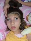 (Hipsarritmia; Síndrome <b>de</b> West; Espasmos em Canivete; Espasmo <b>de</b> Anuência;