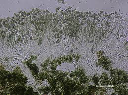 Attēlu rezultāti vaicājumam “Calicium viride”