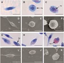 Image result for Cancer borealis