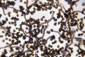 Attēlu rezultāti vaicājumam “Lophocolea bidentata”