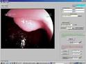 Software to Support a Medical Practitioner in an Endoscopic