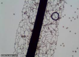 Attēlu rezultāti vaicājumam “Stemonitis splendens spores”