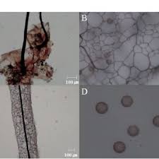 Attēlu rezultāti vaicājumam “Stemonitis pallida spores”