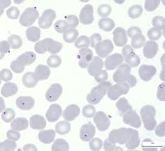 Attēlu rezultāti vaicājumam “Enteridium variabile plasmodium”
