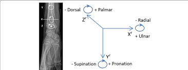 Image result for D.A.R.E!! Development + RadiSense III X-Axis