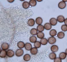 Attēlu rezultāti vaicājumam “Diderma globosum”