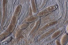 Attēlu rezultāti vaicājumam “Pertusaria leioplaca”