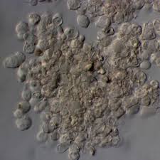 Attēlu rezultāti vaicājumam “Erythricium aurantiacum”