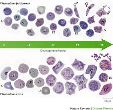 Attēlu rezultāti vaicājumam “Dianema depressum plasmodium”