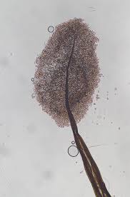 Attēlu rezultāti vaicājumam “Comatricha tenerrima stalked”