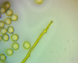 Attēlu rezultāti vaicājumam “Trichia erecta spores”