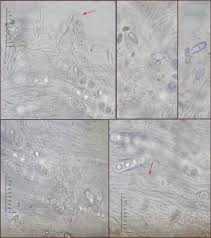Attēlu rezultāti vaicājumam “Acrocordia gemmata”