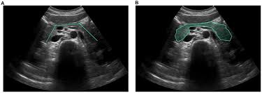 Image result for Kamal Orlando Ibrahim