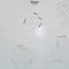 Attēlu rezultāti vaicājumam “Hymenoscyphus fructigenus”