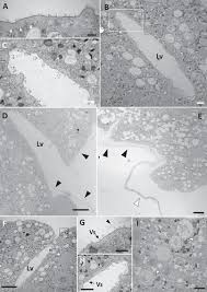 Attēlu rezultāti vaicājumam “Lamproderma arcyrioides stalked”