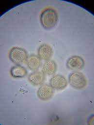 Attēlu rezultāti vaicājumam “Trichia erecta”