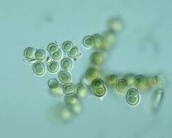 Attēlu rezultāti vaicājumam “Gloeocapsa rupestris”