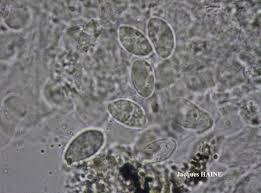 Attēlu rezultāti vaicājumam “Verrucaria hydrela”