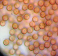 Attēlu rezultāti vaicājumam “Stemonitis pallida var. rubescens”