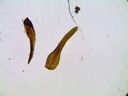 Attēlu rezultāti vaicājumam “Gyroweisia tenuis”