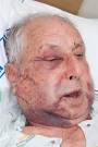 War veteran and assault victim Eric Brady. Credit:NZPA / NZ Police - war_veteran_and_assault_victim_eric_brady_credit_n_1886266822
