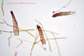 Attēlu rezultāti vaicājumam “Bryum pallescens”