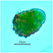 Attēlu rezultāti vaicājumam “Buxbaumia viridis sporophyte”