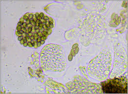 Attēlu rezultāti vaicājumam “Licea pygmaea spores”