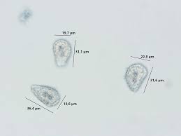 Attēlu rezultāti vaicājumam “Milesina murariae”