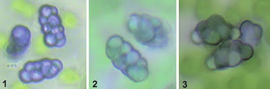 Attēlu rezultāti vaicājumam “Calypogeia sphagnicola”