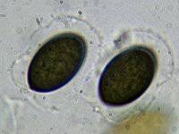 Attēlu rezultāti vaicājumam “Sordaria fimicola”