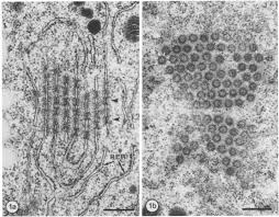 Attēlu rezultāti vaicājumam “Leiocolea rutheana cells”