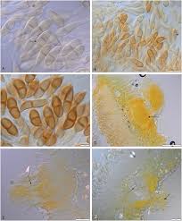 Attēlu rezultāti vaicājumam “Pucciniales”