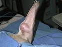 Mast cell tumors