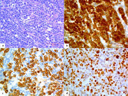 Attēlu rezultāti vaicājumam “Leiocolea rutheana cells”