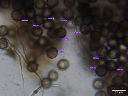 Attēlu rezultāti vaicājumam “Enerthenema papillatum spores”