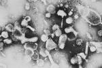 File:Feline leukemia virus.JPG - Wikipedia, the free encyclopedia