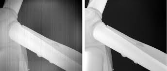 Image result for thermographie-aufnahmen