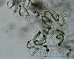 Attēlu rezultāti vaicājumam “Nostoc commune cells”