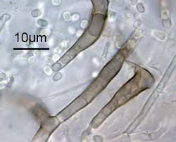 Attēlu rezultāti vaicājumam “Hymenoscyphus sp.”