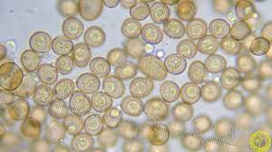 Attēlu rezultāti vaicājumam “Metatrichia floriformis spores”