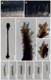 Attēlu rezultāti vaicājumam “Rosellinia desmazieri spores”