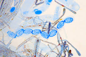 Attēlu rezultāti vaicājumam “Melastiza chateri”