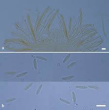 Attēlu rezultāti vaicājumam “Hymenoscyphus imberbis”